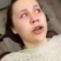 Girl Wakes Up From Wisdom Tooth Surgery As Kylie Jenner [VIDEO]